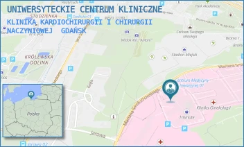 KLINIKA KARDIOCHIRURGII I CHIRURGII NACZYNIOWEJ - UNIWERSYTECKIE CENTRUM KLINICZNE - MARIANA SMOLUCHOWSKIEGO 17, GDAŃSK