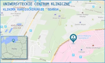 KLINIKA KARDIOCHIRURGII - UNIWERSYTECKIE CENTRUM KLINICZNE - UL. MARIANA SMOLUCHOWSKIEGO 17, GDAŃSK